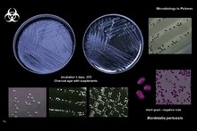 bordetella